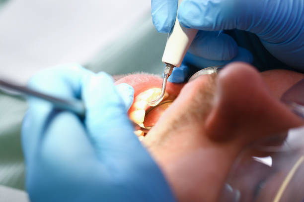 Best Broken Tooth Emergency  in Wilton, IA